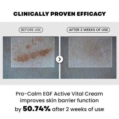 [PRO-CALM] EGF Active Vital Cream