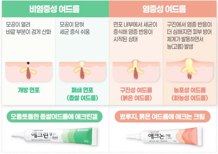 Aclean Gel - Comedonal Acne Treatment Gel (20g)